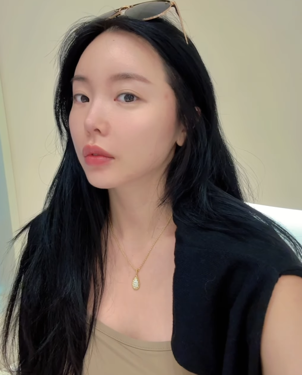 가수 홍진영이 바쁜 일정 속 미뤄왔던 피부 관리를 다시 시작하며 한층 맑아진 근황을 공개했다./홍진영 소셜미디어