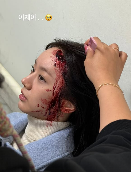 혜리./혜리 인스타그램