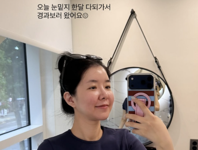 그룹 캣츠 출신 인플루언서 김지혜가 눈 밑 지방 재배치(이하 ‘눈밑지’) 수술 한 달 차 경과를 전하며 놀라움을 금치 못했다./김지혜 소셜미디어