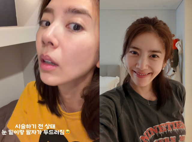 손담비가 자신이 직접 받은 피부 관리 시술 후기를 솔직하게 공개했다. / 손담비 SNS