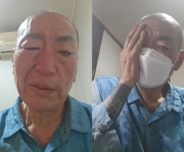 유퉁이 건강 이상 증세를 호소하며 당분간 활동을 중단하고 치료에 전념하겠다는 뜻을 밝혔다. / 유퉁 SNS