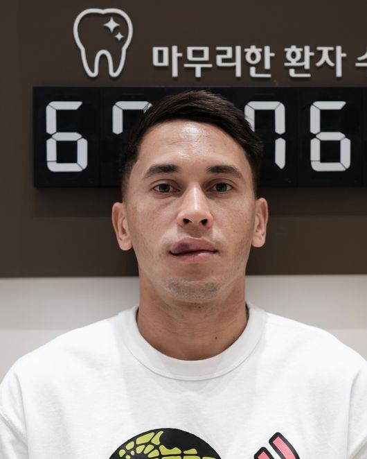 팔꿈치에 가격 당한 후 안면 부상을 당한 수원 삼성 헤이스./수원 삼성