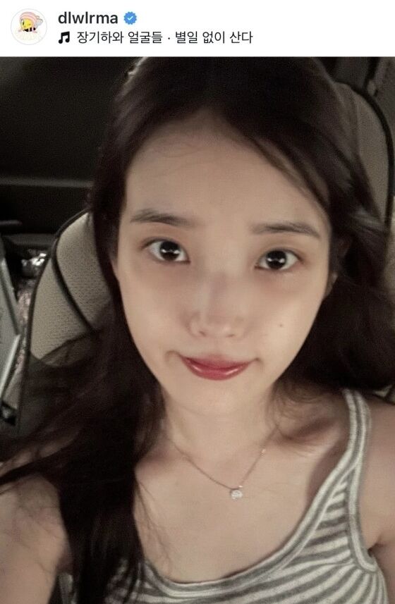 아이유./소셜미디어