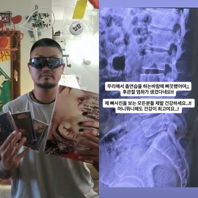 래퍼 던밀스, 던밀스가 게재한 사진./던밀스 소셜미디어