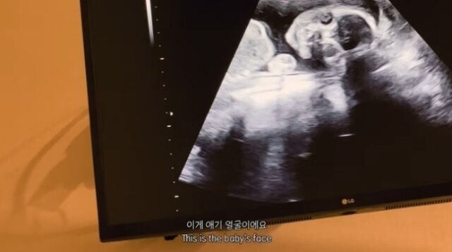 / 안나 유튜브