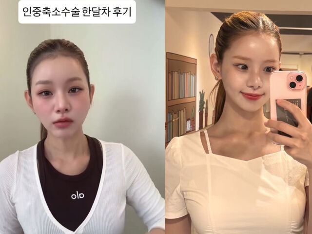 맹승지가 성형을 고백했다. / 맹승지 소셜미디어