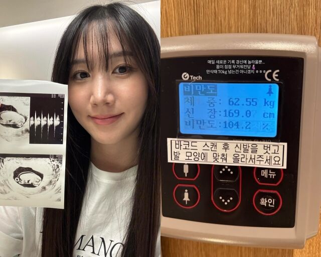 그룹 에이핑크 출신 홍유경, 홍유경이 게재한 사진./홍유경 소셜미디어
