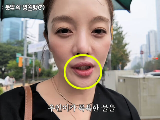 황보라가 전 영상에서 한 교정기를 끼지 않고 출연해 의문을 샀다. / 유튜브 '황보라 보라이어티'
