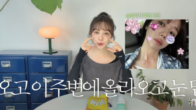 지난 22일 유튜브 채널 '윤은혜의 은혜로그인'에는 '건강에 진심인 은혜의 9월 파우치템'이라는 제목의 영상이 공개됐다. 이날 윤은혜는 최근 겪었던 피부 질환과 치료 과정에 대해 말문을 열었다./유튜브 채널 '윤은혜의 은혜로그인'