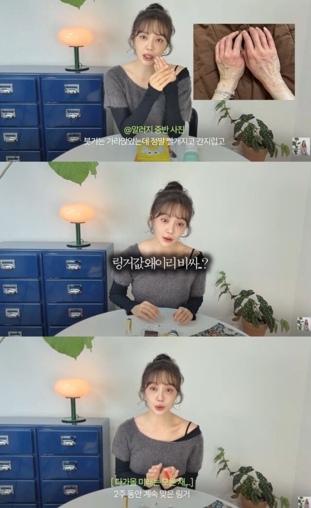 배우 윤은혜가 최근 온몸을 덮친 심각한 알레르기 증상으로 극심한 고통을 겪었던 사실을 털어놨다. /유튜브 채널 '윤은혜의 은혜로그인'