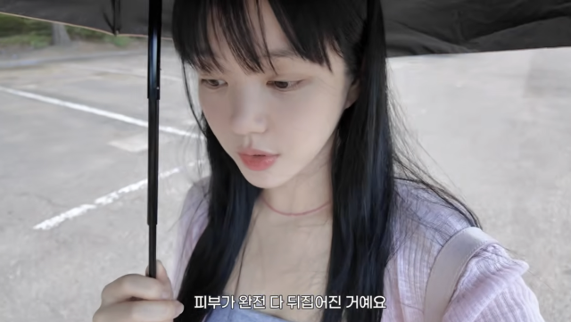이유비가 촬영 이후 심해진 햇빛 알레르기로 피부 관리에 신경 쓰고 있는 근황을 전했다. / 유튜브 채널 '이유비 DDOYUBI'