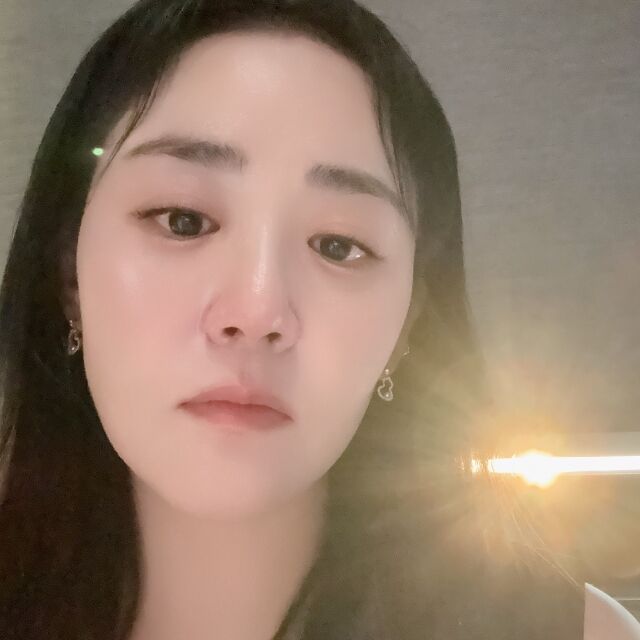 배우 문근영./문근영 소셜미디어