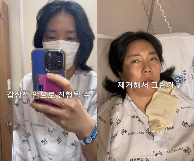 허안나가 갑상선 수술 이후 극심한 피로감에 시달리고 있다고 고백했다. / 허안나 SNS