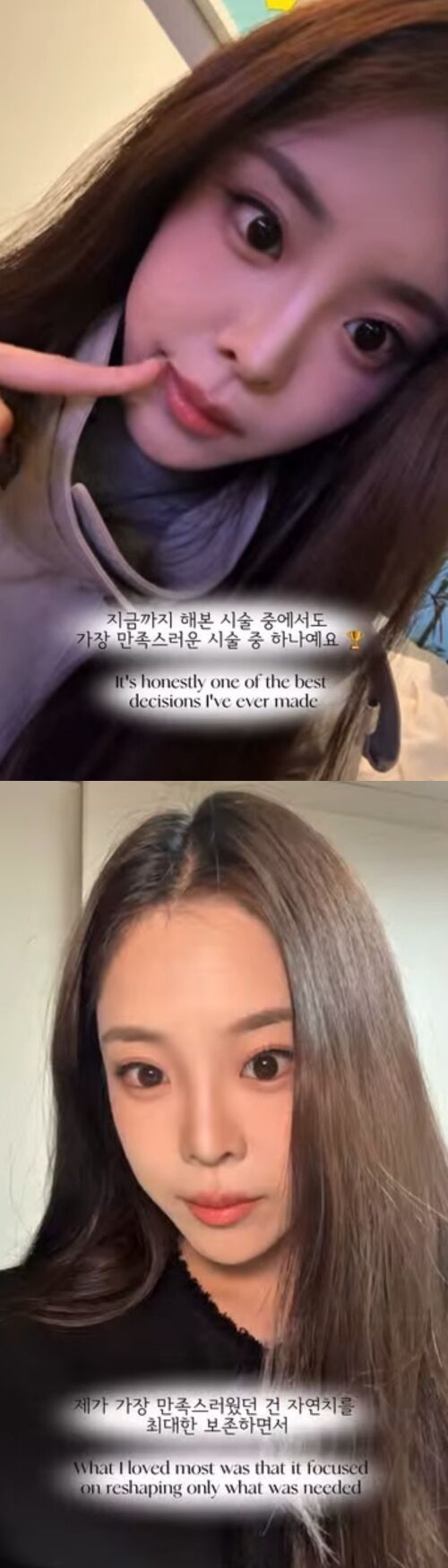 우서윤이 치아시술을 고백하며 밝은 미소가 담긴 근황을 전했다. / 우서윤 소셜미디어 갈무리