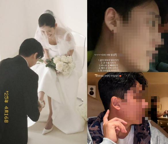 인플루언서 최준희가 남편 코수술을 시켰다고 밝혔다. / 최준희 소셜미디어